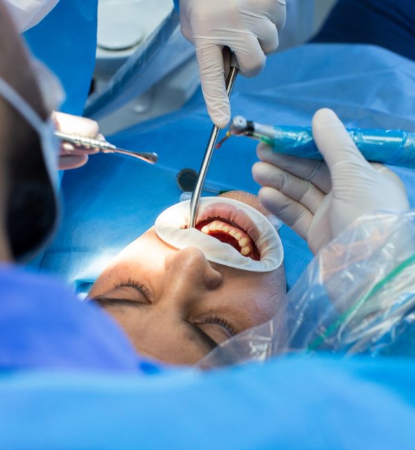 Extracción Dental