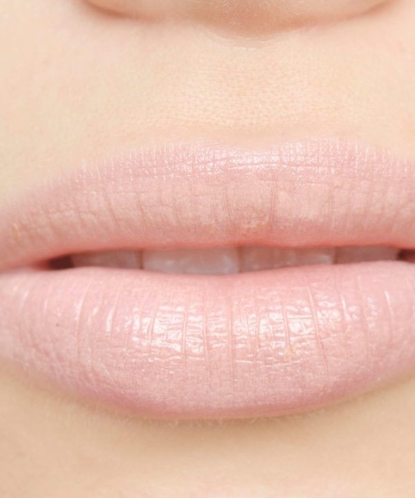 Labios-y-Zona-Peribucal2