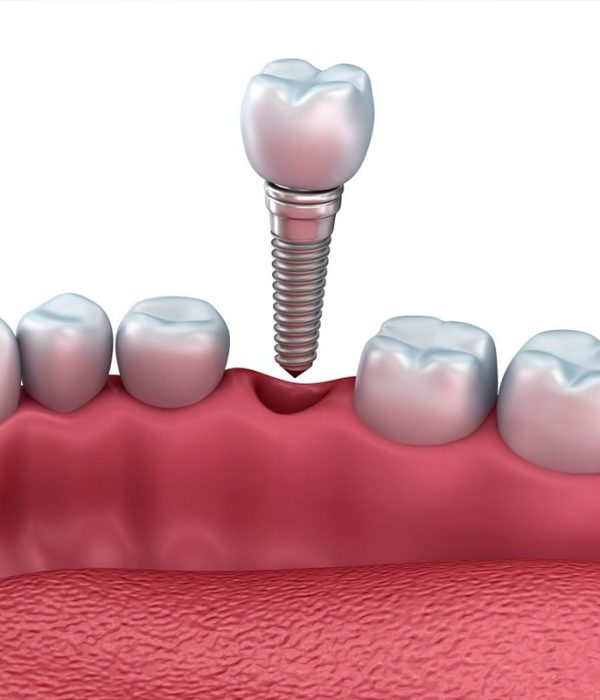 extracciondientes2